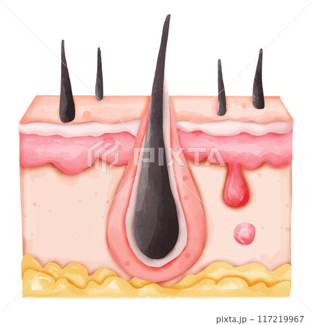 Watercolor Illustration of a Healthy Hair Follicle in Skin 117219967