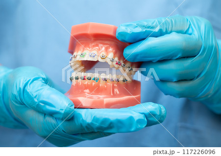 Dentist holding dental teeth model to study and treat in hospital. Dentist holding dental teeth model to study and treat in hospital. 117226096