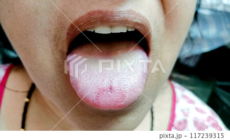 Close up of mouth of woman showing tongue Close up of mouth of woman showing tongue 117239315