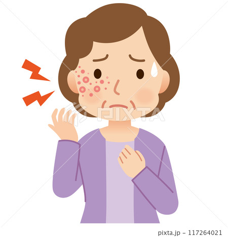 帯状疱疹ができて痛みがある中年女性　症状 117264021