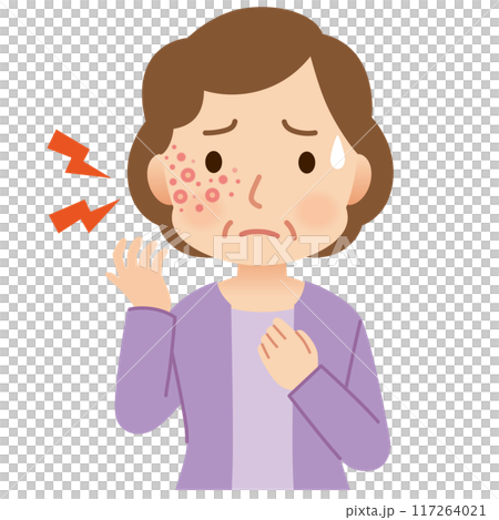 帯状疱疹ができて痛みがある中年女性　症状 117264021