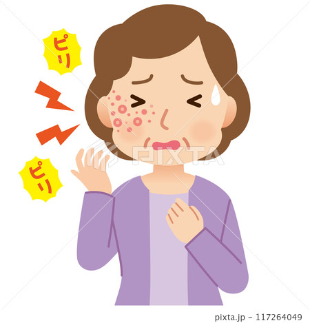 帯状疱疹ができて痛みがある中年女性　症状 117264049