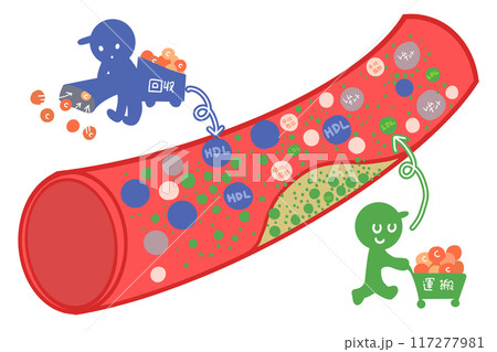 生活習慣病とコレステロールと血管 生活習慣病とコレステロールと血管 117277981