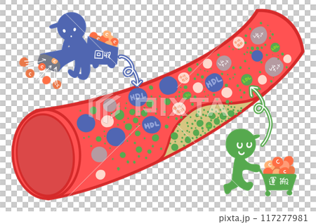 生活習慣病とコレステロールと血管 生活習慣病とコレステロールと血管 117277981
