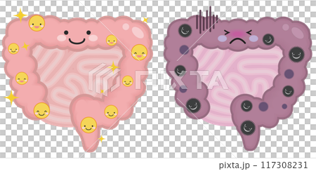 Healthy and unhealthy intestines 117308231