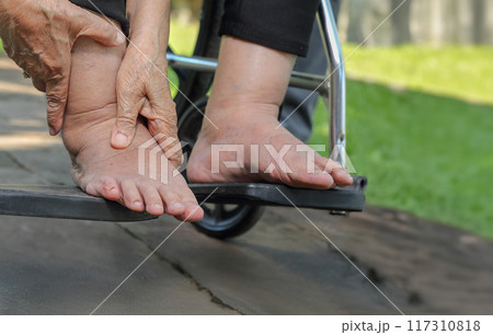 Elderly Woman Massaging Swollen Feet in Wheelchair. Elderly Woman Massaging Swollen Feet in Wheelchair. 117310818