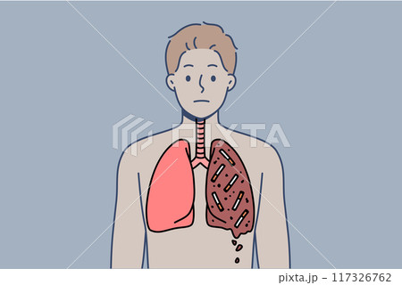Man smoker with destroyed lungs is forced to suffer due to addiction to tobacco and nicotine 117326762