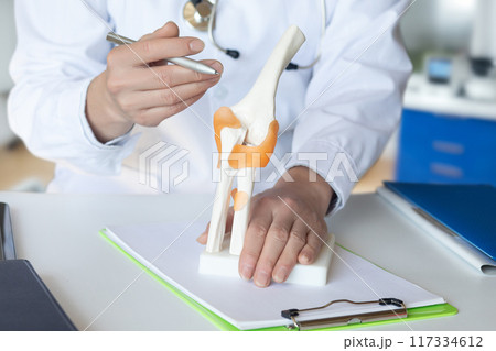 Doctor shows joint problems on model. 117334612