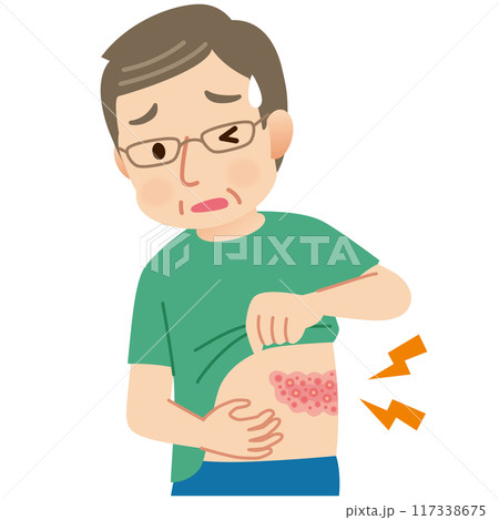 帯状疱疹ができて痛みがある中年男性 症状 帯状疱疹ができて痛みがある中年男性 症状 117338675