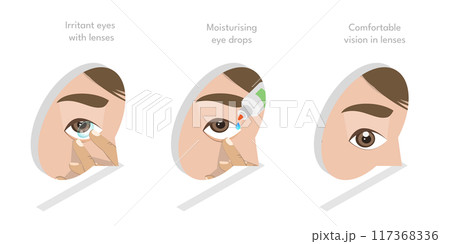 3D Isometric Flat Illustration of Moisturizing Eye Drops, Using of Artificial Tears 3D Isometric Flat Illustration of Moisturizing Eye Drops, Using of Artificial Tears 117368336
