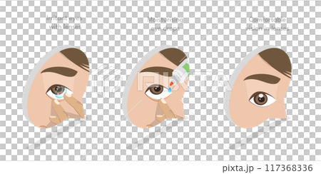 3D Isometric Flat Illustration of Moisturizing Eye Drops, Using of Artificial Tears 3D Isometric Flat Illustration of Moisturizing Eye Drops, Using of Artificial Tears 117368336
