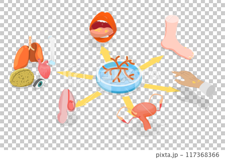 3D Isometric Flat  Illustration of Candidiasis, Medical Infographics 117368366