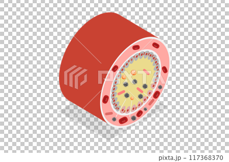 3D Isometric Flat Illustration of Celiac Disease, Gluten Intolerance 3D Isometric Flat Illustration of Celiac Disease, Gluten Intolerance 117368370