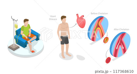 3D Isometric Flat Illustration of Chelation Therapy, Toxic Heavy Metal Medical Treatment 3D Isometric Flat Illustration of Chelation Therapy, Toxic Heavy Metal Medical Treatment 117368610