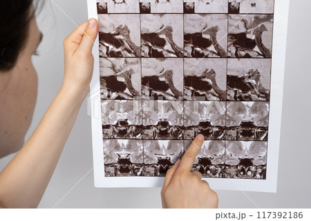 The doctor holds an MRI image of the pituitary gland of a healthy person. The doctor holds an MRI image of the pituitary gland of a healthy person. 117392186