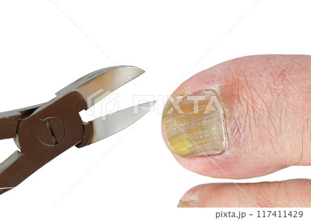 変色した足指の手入れ 117411429