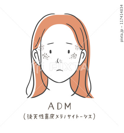 シミ（ADM）に悩む女性のイラスト素材 117414834