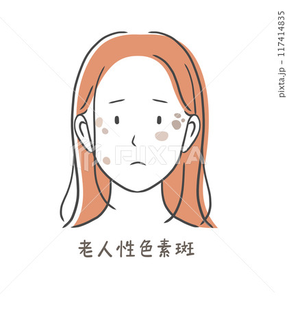 シミ（老人性色素斑）に悩む女性のイラスト素材 117414835