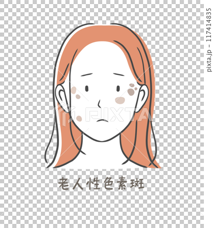 Illustration material of a woman suffering from age spots (senile lentigo) 117414835