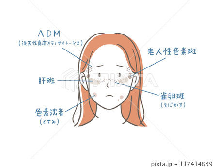 シミの種類と女性の顔のイラスト素材 117414839