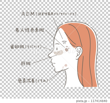 シミの種類と横顔の女性のイラスト素材 117414840