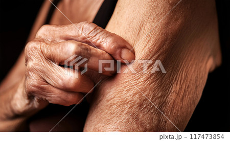 Elderly Lady Showing Loose Skin or Flab Due to Aging on Her Lower Arm - Generative Ai Elderly Lady Showing Loose Skin or Flab Due to Aging on Her Lower Arm - Generative Ai 117473854