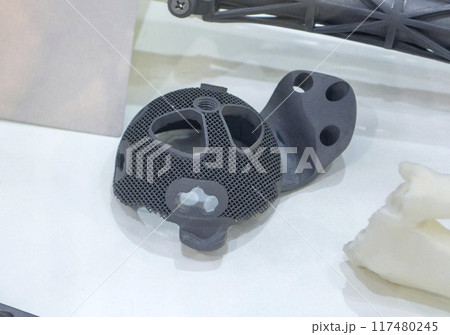 Implant of joint printed on a 3D printer from biocompatible titanium. Individual 3D-handled acetabular system. Endoprosthesis. Biointegrated patient-specific prosthesis. Medicine medical 117480245