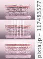 Skin before and after laser collagen-boosting therapy. Stylized wrinkled and tightened skin layer 3D render 117483577