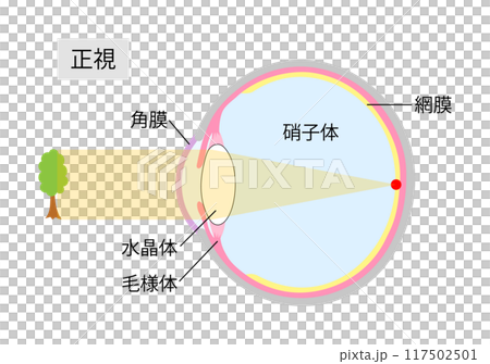 Cross-section of the eye showing normal vision 2 Cross-section of the eye showing normal vision 2 117502501