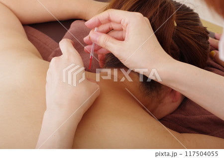 鍼灸院で背中に鍼治療をする女性 鍼灸院で背中に鍼治療をする女性 117504055
