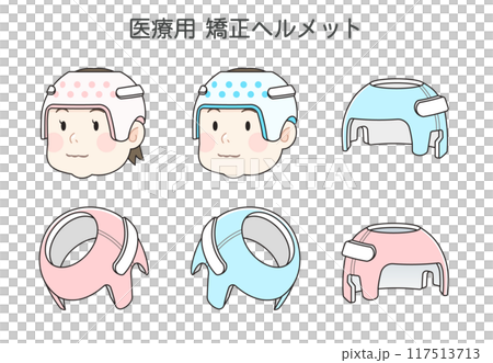 矯正頭盔 嬰兒 嬰兒 插圖 117513713