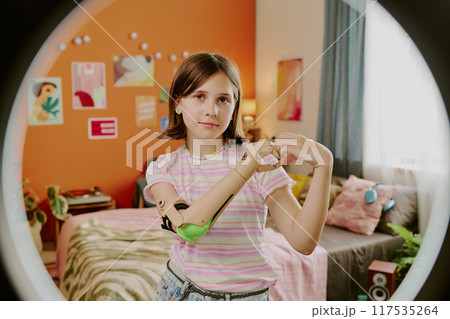 Gen alpha teen blogger with arm prosthesis posing for camera with hand heart in front of lamp on tripod 117535264