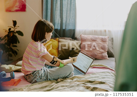 Teen girl with disability wearing arm prosthesis learning Math with use of laptop and Internet while sitting on bed in her bedroom 117535351