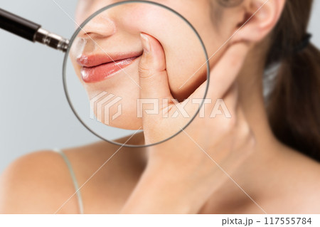 豊麗線をリフトアップする女性の頬をルーペで拡大している。 豊麗線をリフトアップする女性の頬をルーペで拡大している。 117555784