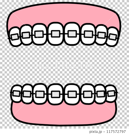 Orthodontics: Teeth and gum frame material 117572797