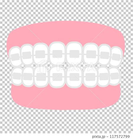 Orthodontics: Illustration of a simple dental model 117572799