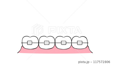 歯列矯正 並んだ歯のイラスト 歯列矯正 並んだ歯のイラスト 117572806