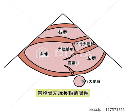 心エコー傍胸骨左縁長軸断層像（文字あり） 117573851
