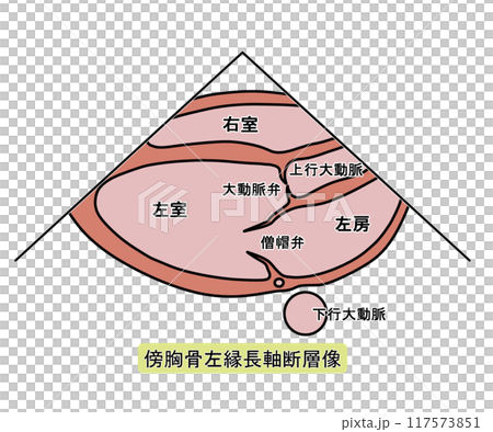心エコー傍胸骨左縁長軸断層像（文字あり） 117573851
