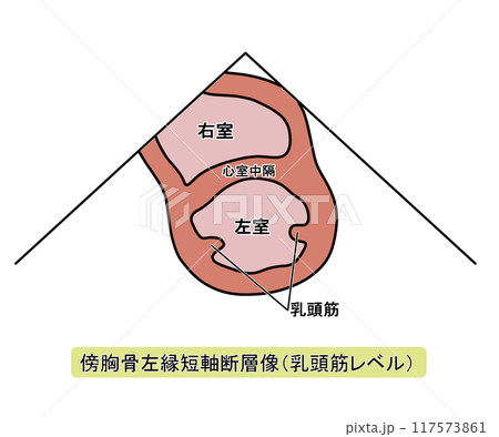 傍胸骨左縁短軸断層像乳頭筋レベル（文字あり） 117573861