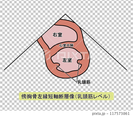 傍胸骨左縁短軸断層像乳頭筋レベル（文字あり） 117573861