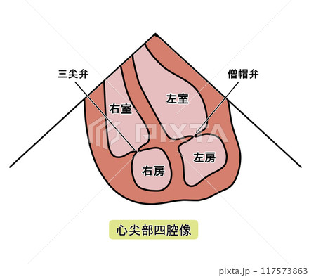 心エコー 心尖部四腔像（文字あり） 117573863
