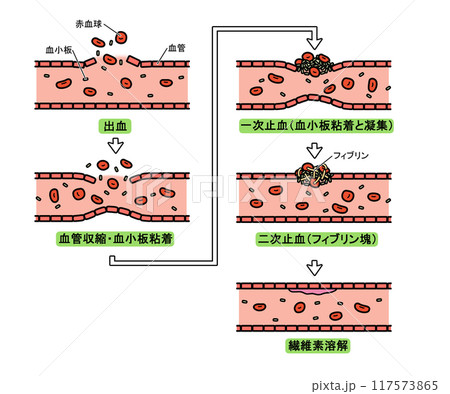 血液凝固の流れ(文字あり) 血液凝固の流れ(文字あり) 117573865