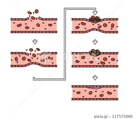 血液凝固の流れ（文字なし） 117573866