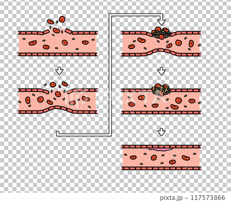 血液凝固の流れ（文字なし） 117573866
