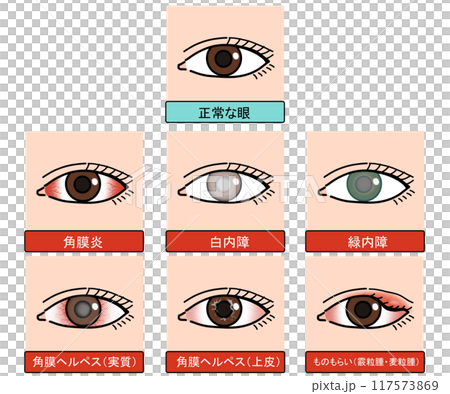 眼の病気（文字あり） 117573869