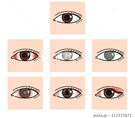 眼の病気（文字なし） 117573871