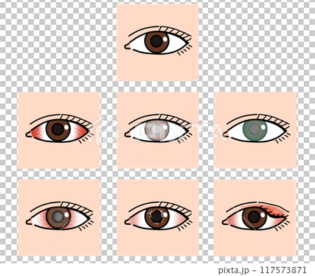 眼の病気（文字なし） 117573871