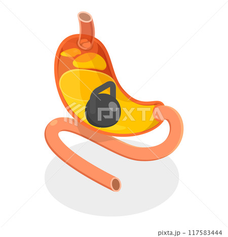 3D Isometric Flat Vector Set of Stomach Problems, Digestive System Issues. Item 2 3D Isometric Flat Vector Set of Stomach Problems, Digestive System Issues. Item 2 117583444