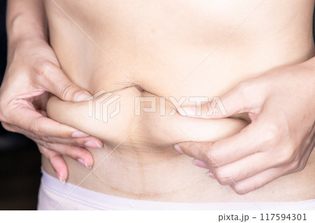 Woman body fat belly, Obese woman hand holding excessive belly fat, Woman using pinch test as one of the methods for measuring body fat on belly, Reduce belly and shape up healthy stomach muscle. Woman body fat belly, Obese woman hand holding excessive belly fat, Woman using pinch test as one of the methods for measuring body fat on belly, Reduce belly and shape up healthy stomach muscle. 117594301